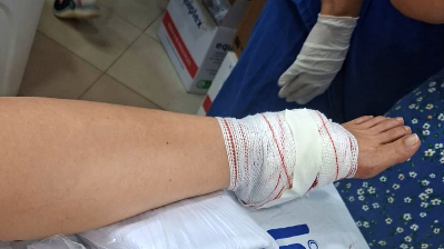 Jovem é executado a tiros no bairro Araxá; mulher que passava na rua é baleada